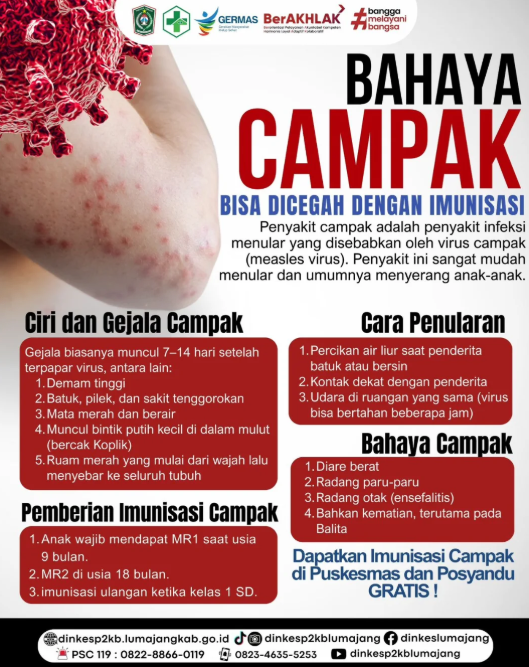  Campak Berbahaya, Imunisasi Solusinya