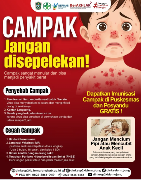 *Waspada Campak! Lindungi Buah Hati dengan Langkah Tepat* 